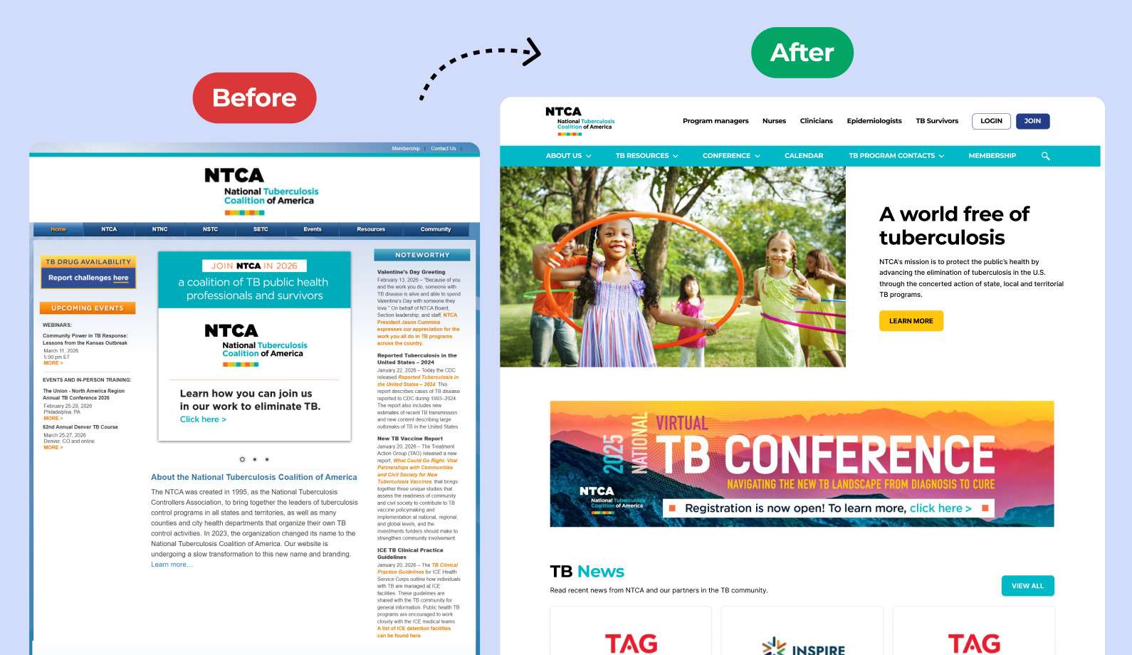 National TB Coalition project